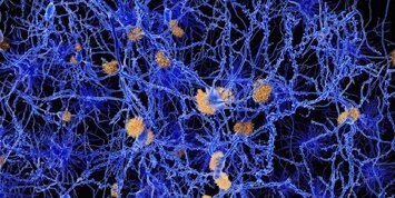 dementia banner
